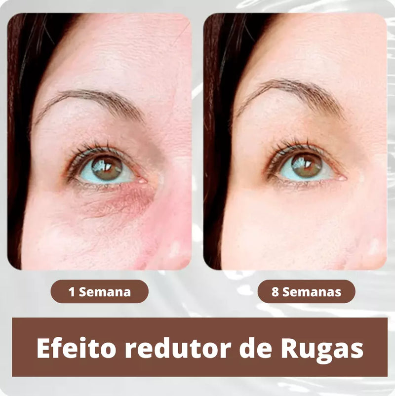 Derma Lift - Pálbebras Firmes e Elevadas com Efeito Permanente